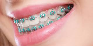 Brackets