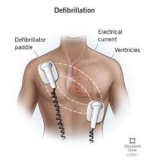 Defibrillator